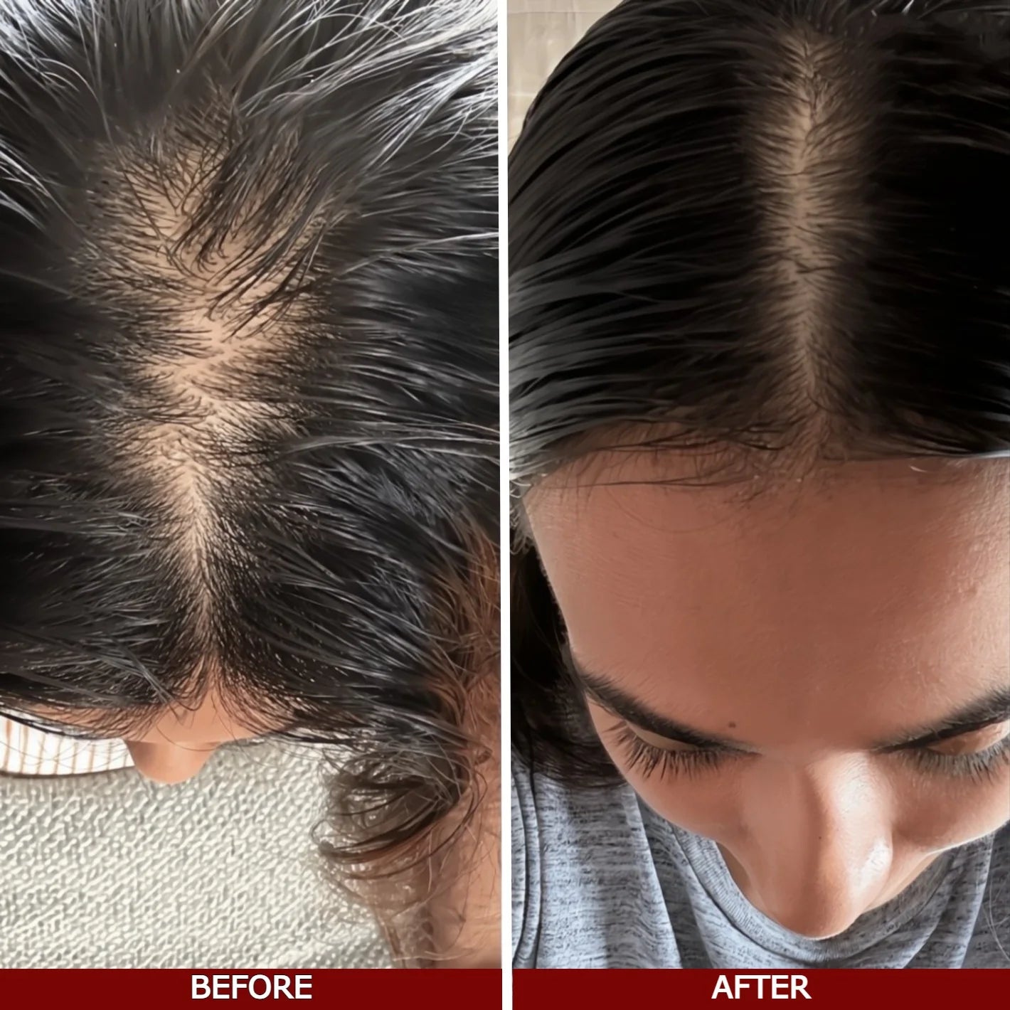 Hair glow hair growth serum