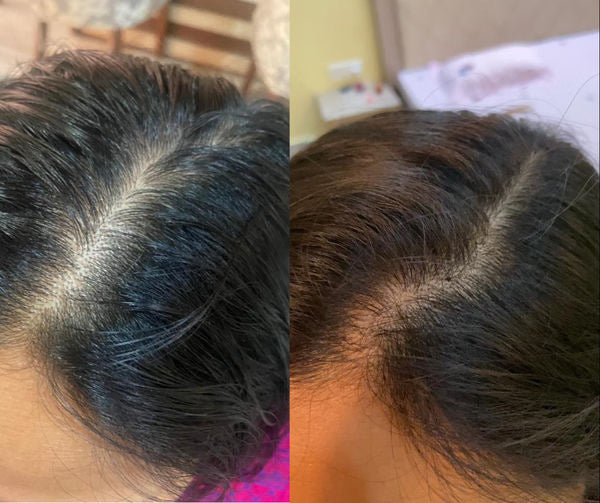 Hair glow hair growth serum